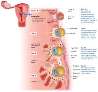 Implantation of the blastocyst in the uterine lining