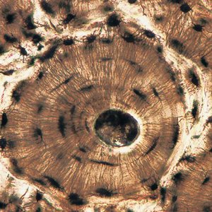 Osteon (Haversian system) in compact bone