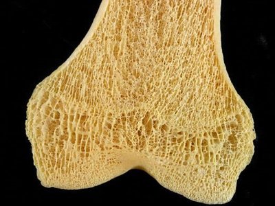 Spongy bone structure