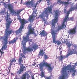 Fibrocartilage histology