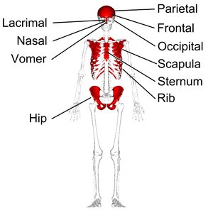 Bone classification by shape
