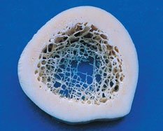 Cross-section of long bone showing compact and spongy bone