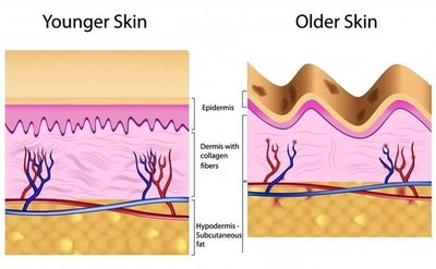 Comparison of younger and older skin structure