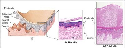 Comparison of thin and thick skin structure