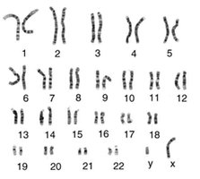 Human karyotype showing autosomes and sex chromosomes