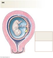 Fetus in uterus with placenta and amniotic fluid