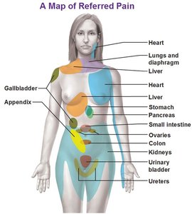 Map of referred pain in the human body