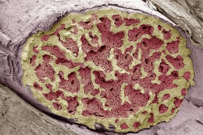 Bone marrow cross-section