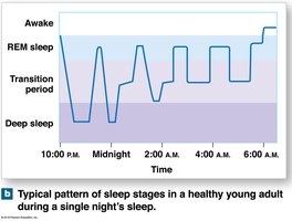 Pattern of sleep stages