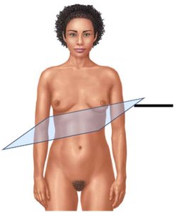 Oblique plane diagram