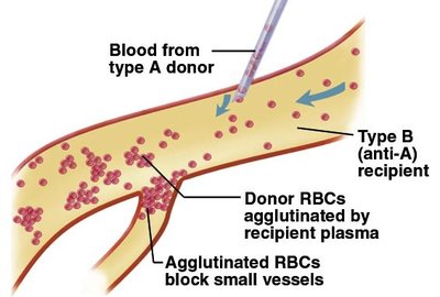 Rh incompatibility in pregnancy