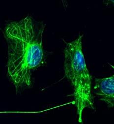 Neurons under microscope
