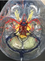 Model of cerebral circulation and Circle of Willis