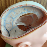 Dural venous sinuses in the brain