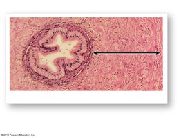 Light micrograph showing thick smooth muscle in the ductus deferens