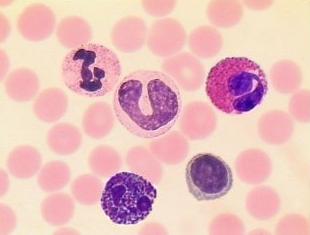 Microscopic view of white blood cells