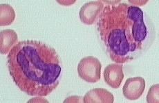 Microscopic view of eosinophils