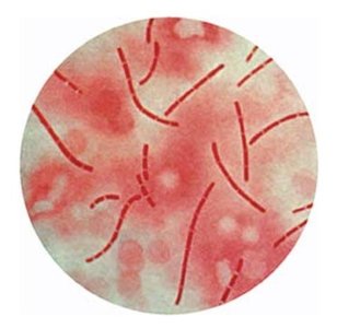 Microorganisms as a Cause of Infection