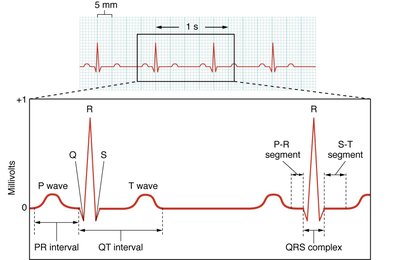 Labeled ECG tracing with P wave, QRS complex, and T wave