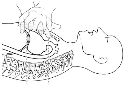 Hand placement for CPR