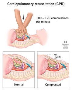 CPR chest compression depth and rate
