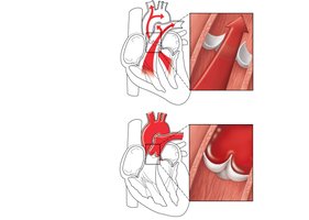 Mechanism of semilunar valve opening and closing