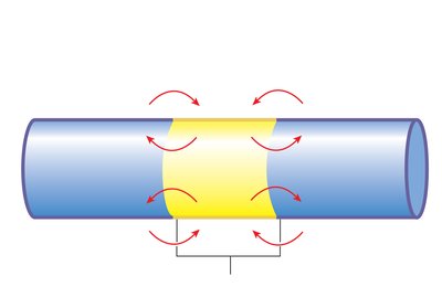 Local current flow in axon