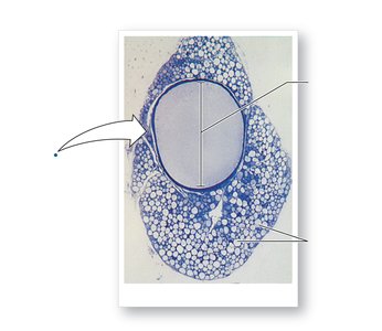 Squid giant axon and axon diameter