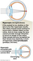 Hyperopia (farsightedness) diagram