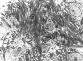 Collagen fibrils in bone