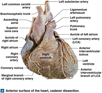 Anterior surface of the heart, cadaver dissection