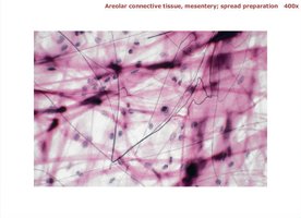 Areolar connective tissue diagram and photomicrograph