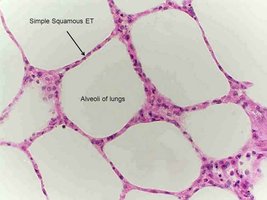 Simple squamous epithelium in alveoli of lungs