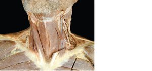 Muscles of the neck and vertebral column causing movements of the head and trunk (dissection)