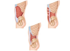 Muscles of the abdominal wall (lateral views)