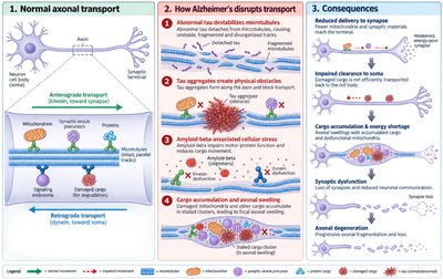 Summary: normal and disrupted axonal transport