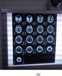 CT scan images
