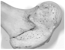 Epiphyseal line in mature bone