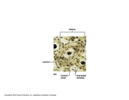 Structure of spongy bone