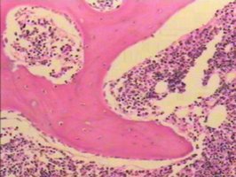 Red and yellow bone marrow in spongy bone