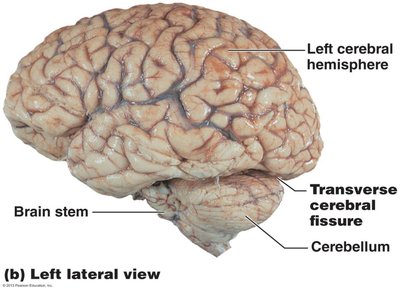 Left lateral view of the cerebral hemispheres