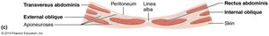Transverse section through the anterolateral abdominal wall