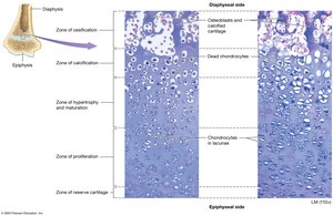 Zones of the epiphyseal plate