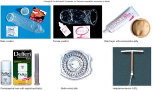 Contraceptive devices: condoms, pills, IUD, etc.