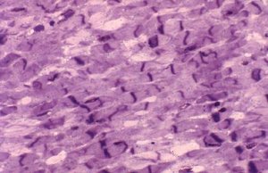 Microscopic anatomy of heart muscle tissue