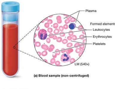 Blood sample showing plasma, formed elements, leukocytes, erythrocytes, and platelets
