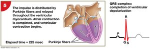 Impulse conduction and ECG tracing