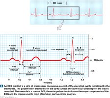ECG printout and wave components