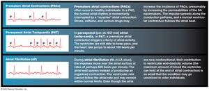 Cardiac arrhythmias examples