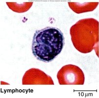 Lymphocyte blood smear